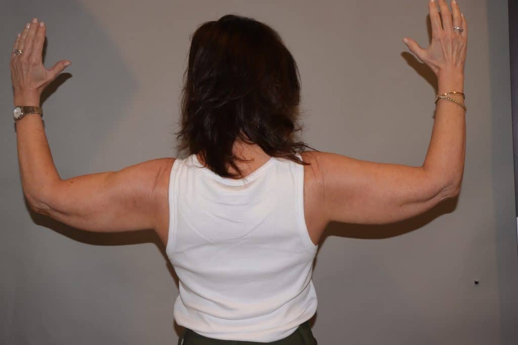 brunette woman wearing a white tank top and green pants back view of arms parallet to the floor for before photos of sofwave for upper arms treatment